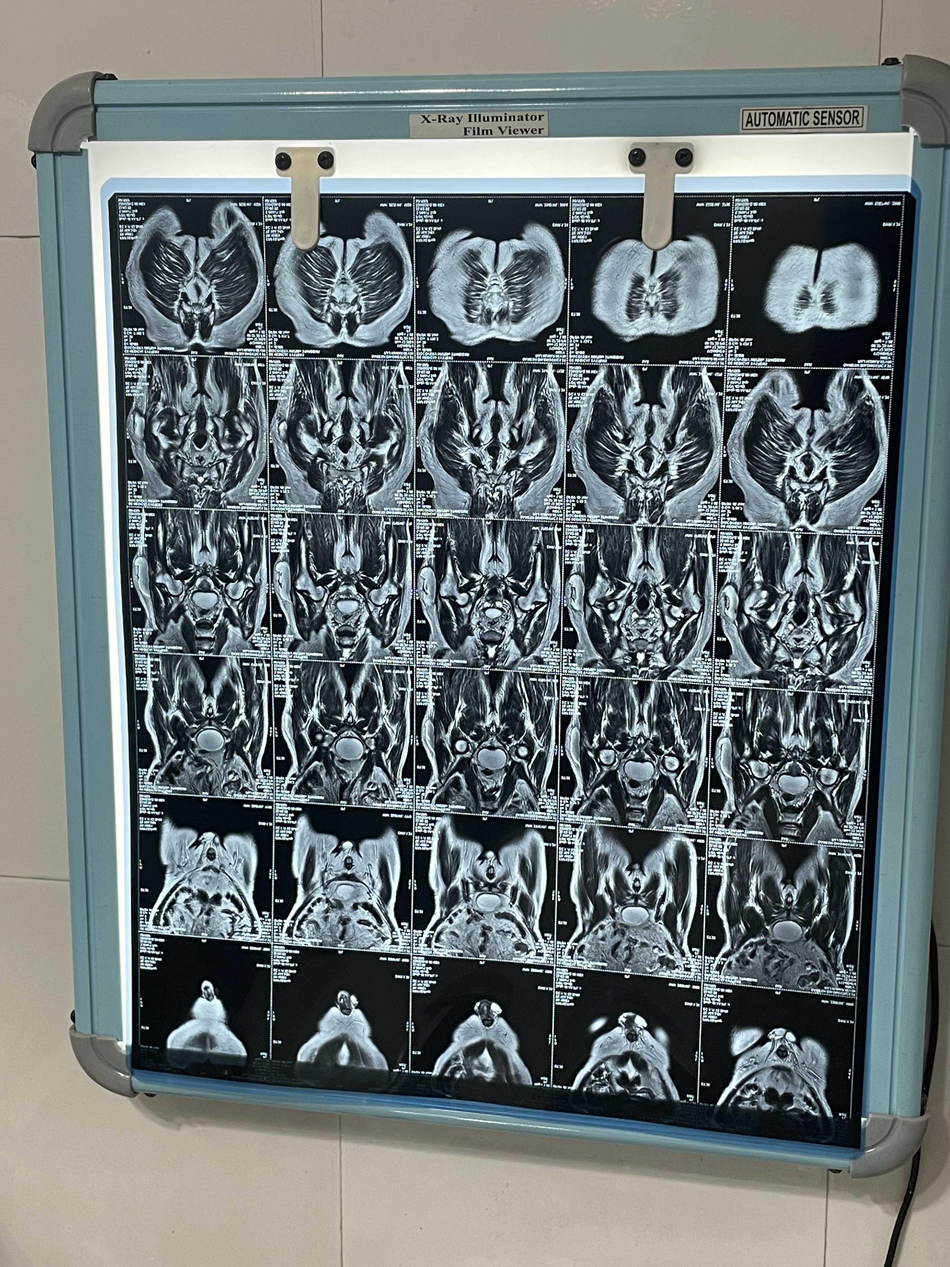 Doctor Consultation